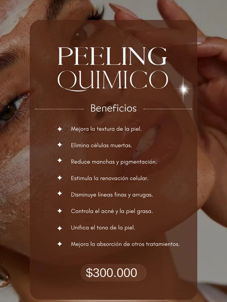 Protocolo Peeling químico