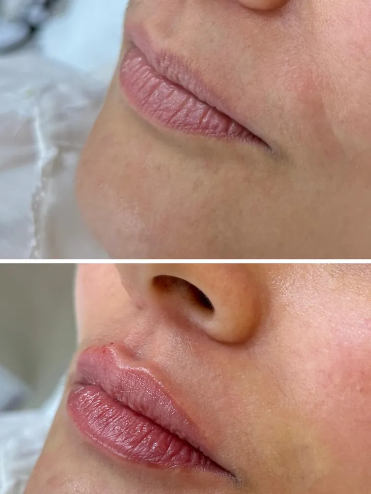 Antes y después: Hidratación de labios