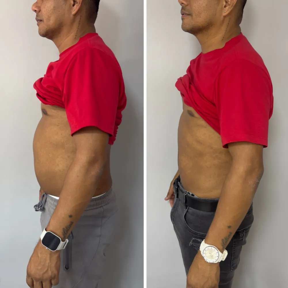 Antes y después: Control de peso