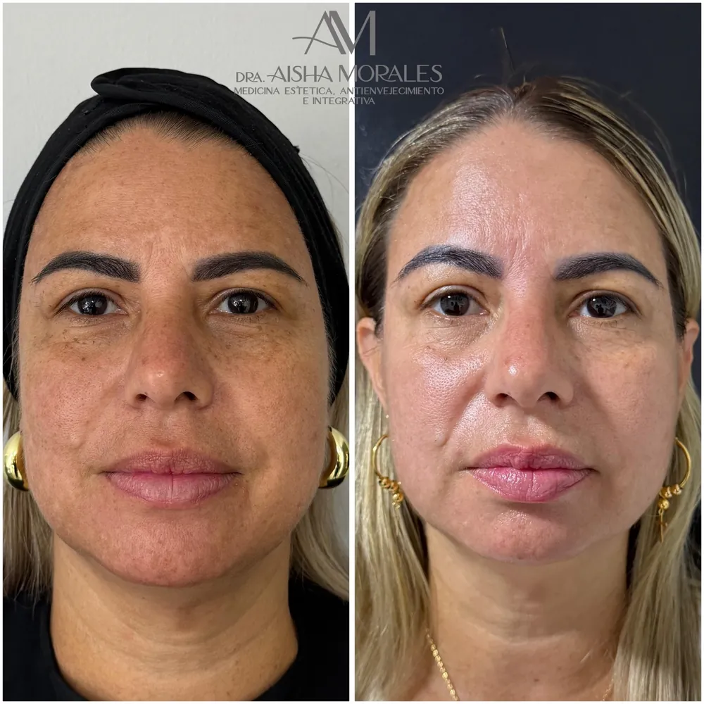 Skin Balance