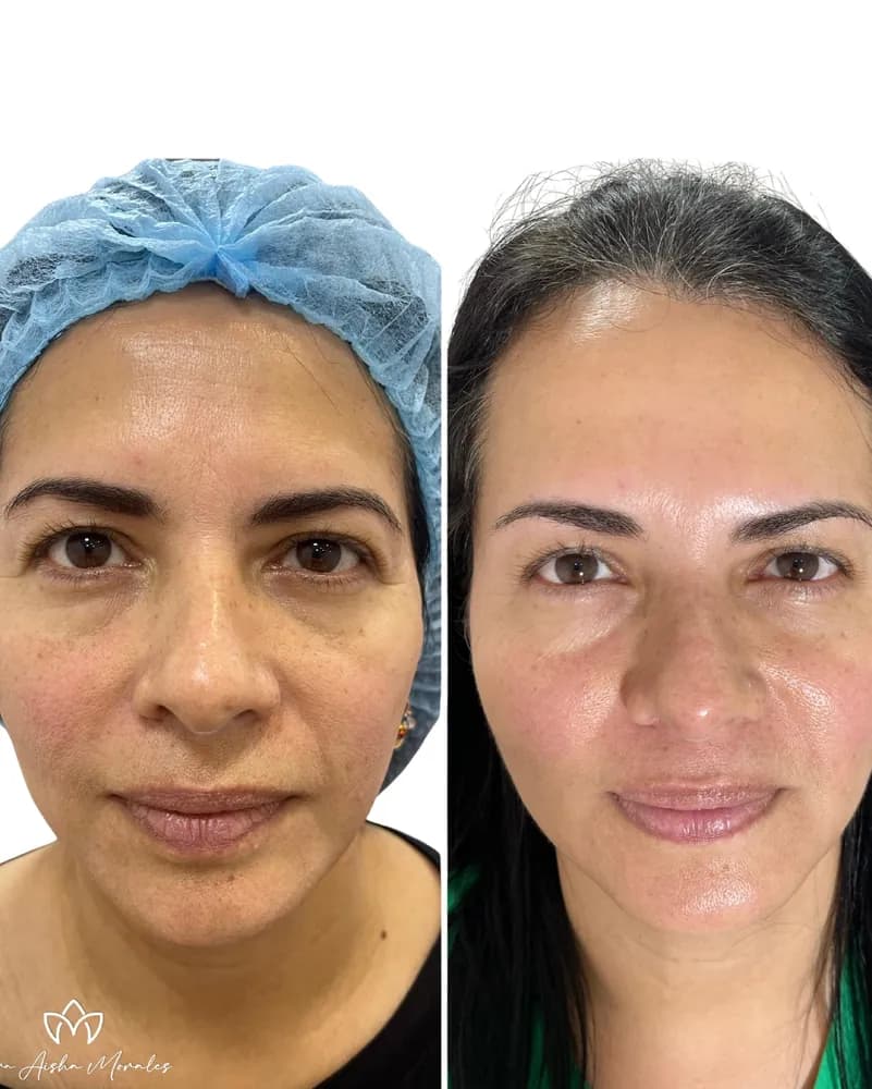 Vital Skin Essence